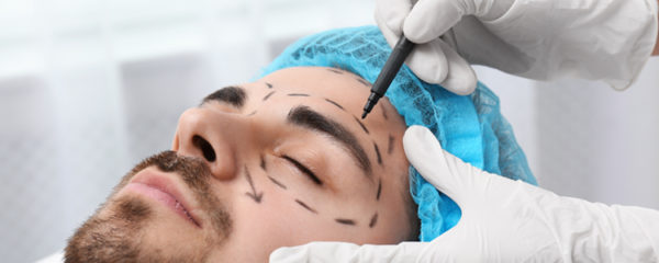 blépharoplastie