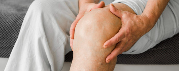 Les varices des jambes : comment les prévenir et les traiter