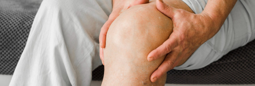 Les varices des jambes : comment les prévenir et les traiter